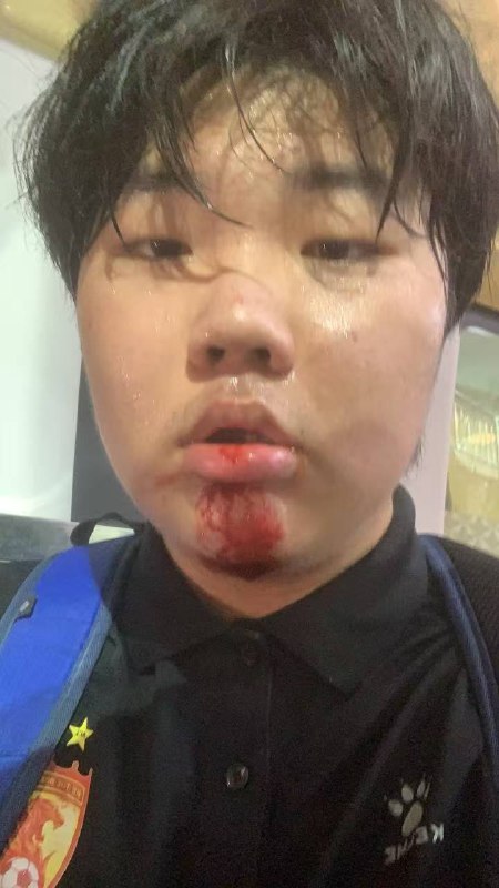 后续，有多名广州球迷到现场后被警察强行带离🕶️ 匿名投稿后续，有多名广州球迷到现场后被警察强行带离🕶️ 匿名投稿