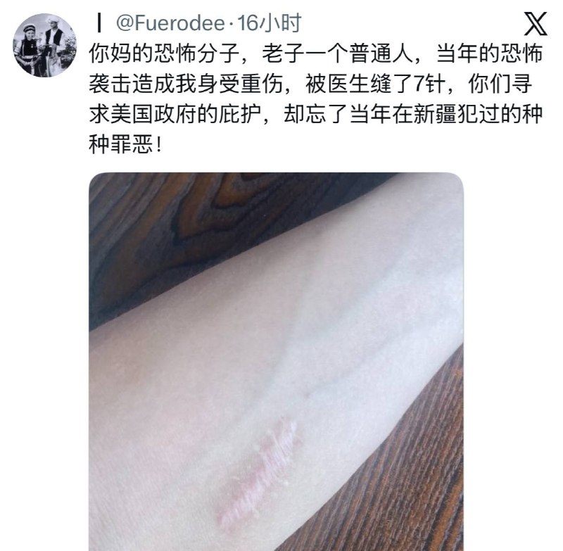 胳膊挺白的，来当小受吧，小编改花刀都比这深，这都叫重伤你们中国没男人了吗？