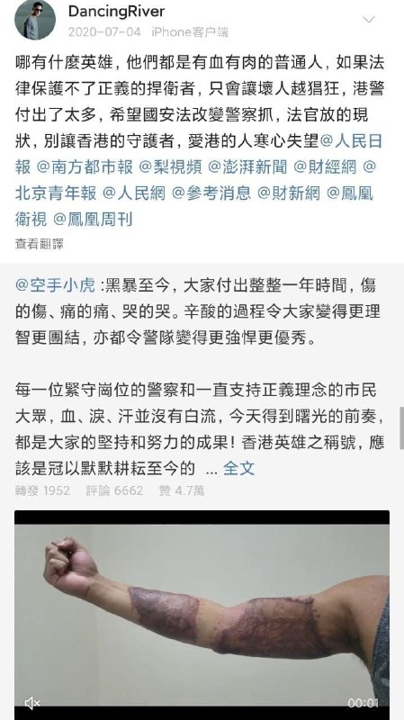 「支持中国黑皮依法止暴治乱❗️早该屠屠了❗️废青，我支持中国黑皮秉公执法❗️」By
