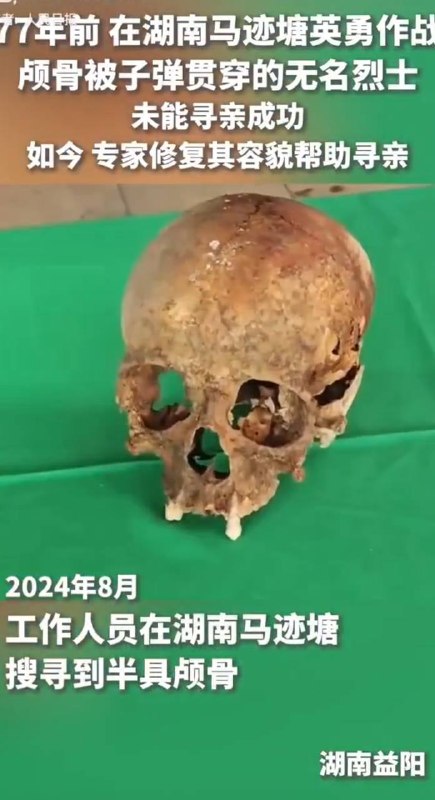 77年前打的那肯定是