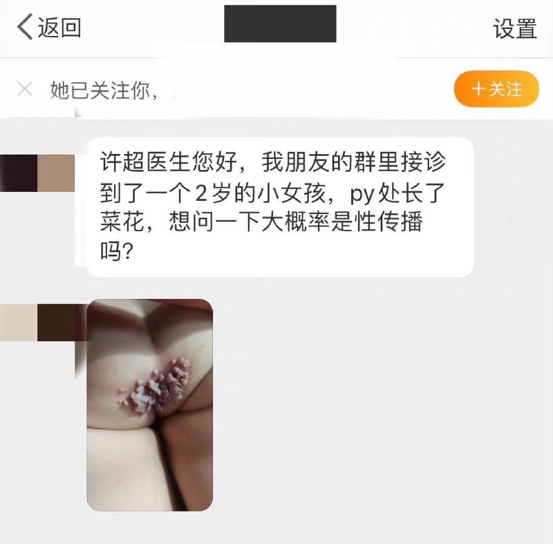 那个医生号 是微博的 专门发性病图片的By