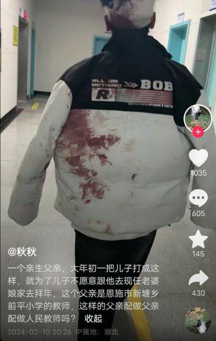 18岁孩子因不愿拜年被打至头破血流2月10日，湖北恩施