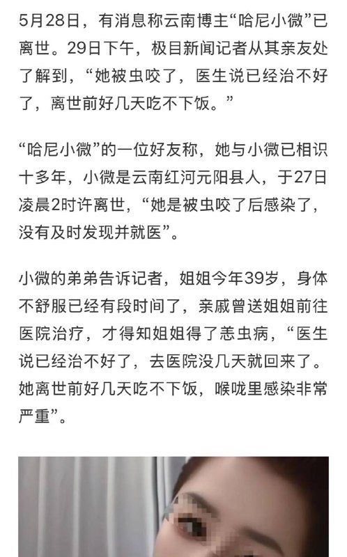 恙虫病虽然凶险，但也