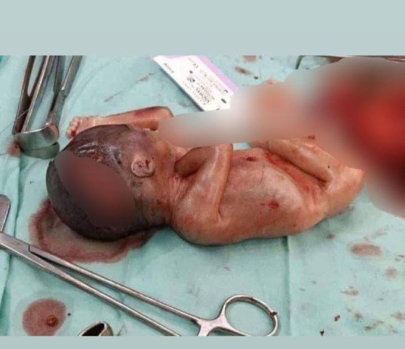 以色列与巴勒斯坦都在互相指责他们杀害儿童这件事情