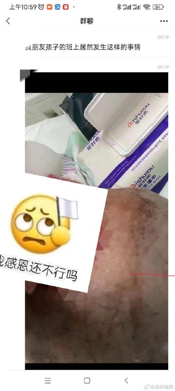 8岁小女孩被老师打出脑浆，学校积极捂嘴长沙梅溪湖小学的宋雨明老师8岁小女孩被老师打出脑浆，学校积极捂嘴长沙梅溪湖小学的宋雨明老师