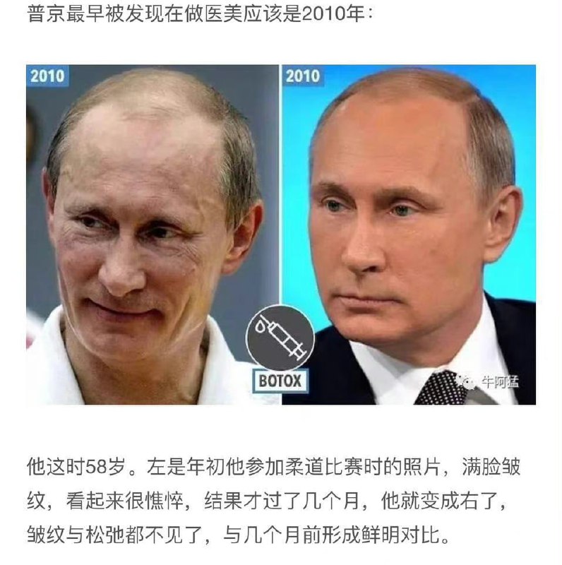 医美成猪皮的普京，不知道习近平做了哪些脸部项目医美成猪皮的普京，不知道习近平做了哪些脸部项目