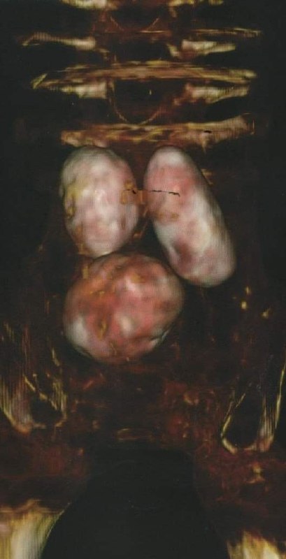 墨西哥于 2023 年 9 月 12 日举行 UFO 国会听证会墨西哥于 2023 年 9 月 12 日举行 UFO 国会听证会