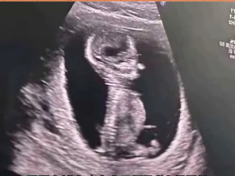 新一届兵王#这就是兔友新一届兵王#这就是兔友