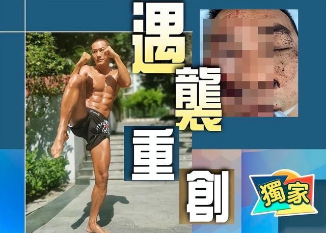 港星黄竣锋深圳遇袭被砍三刀