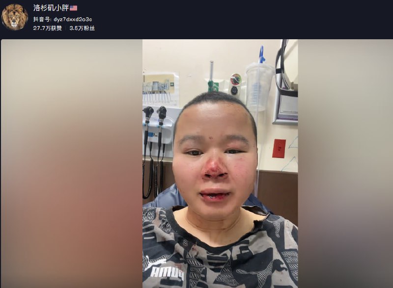 一中国走线客在美国做咸猪手，被美国警方逮捕一中国走线客在美国做咸猪手，被美国警方逮捕