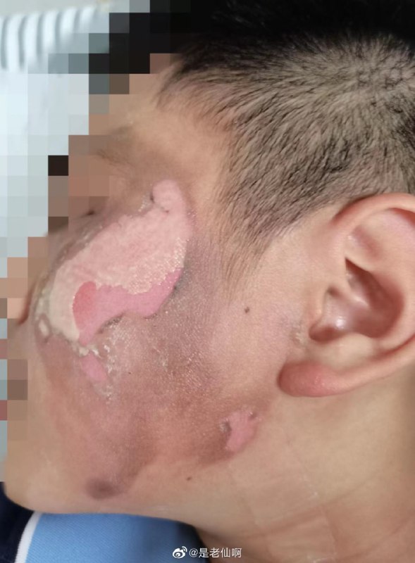 厦门松柏中学官二代霸凌+逼受害者休学厦门松柏中学官二代霸凌+逼受害者休学