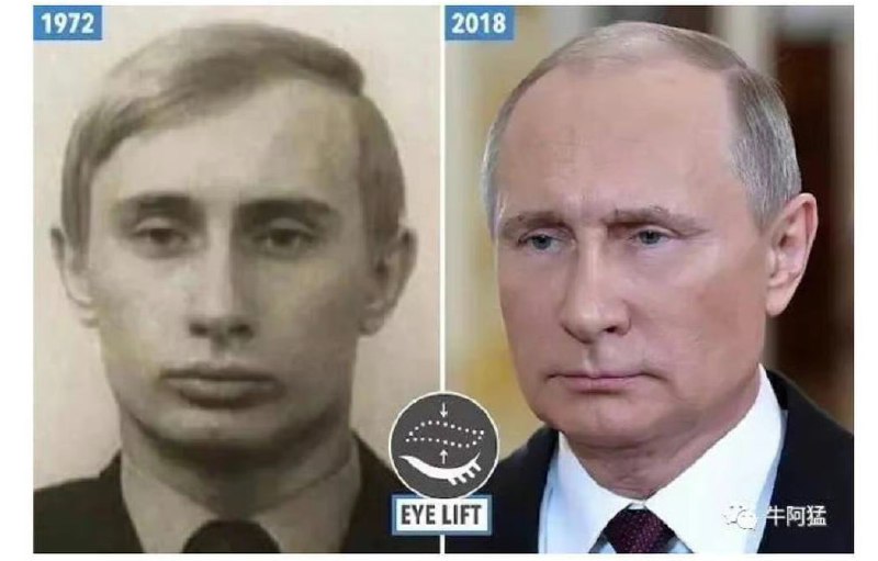 医美成猪皮的普京，不知道习近平做了哪些脸部项目医美成猪皮的普京，不知道习近平做了哪些脸部项目