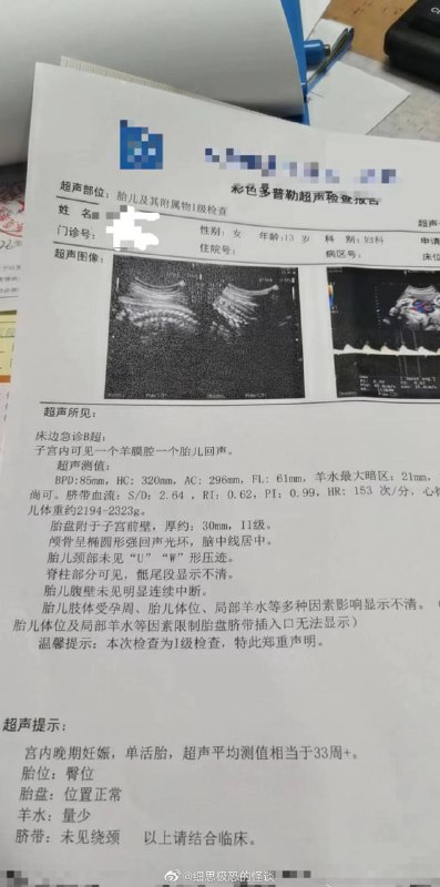 响应三胎政策投稿By