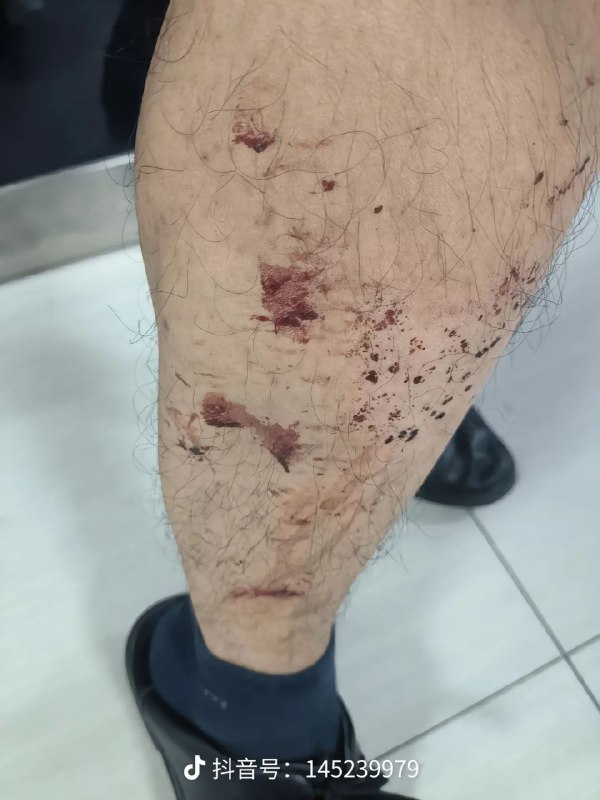 所以起来了吗🤣 让腊肉打赢复活赛 为你主持公道By