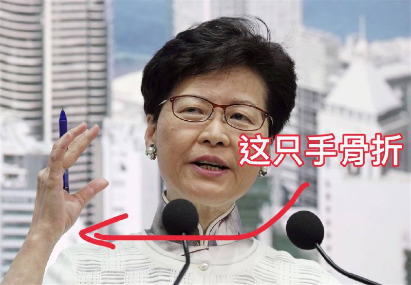 林郑月娥跌倒，右手骨折休假期间李家超代理行政长官职务林郑月娥跌倒，右手骨折休假期间李家超代理行政长官职务