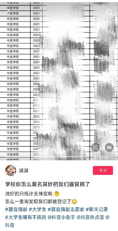 预制器官😁投稿By