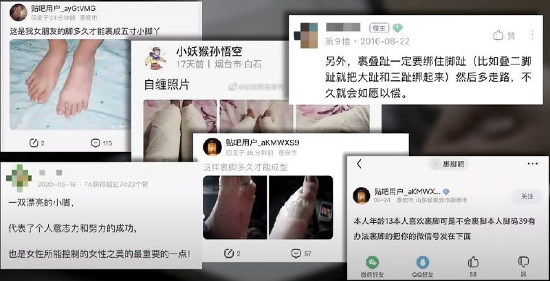 缠足又回来了?投稿By