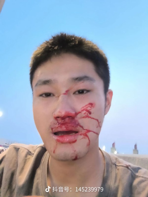 所以起来了吗🤣 让
