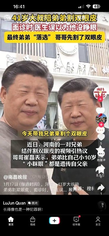 简简单单割个双眼皮（