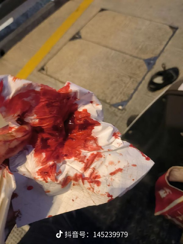 所以起来了吗🤣 让腊肉打赢复活赛 为你主持公道By