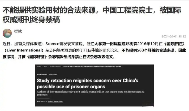 哪来的器官？🕶️ 匿名投稿