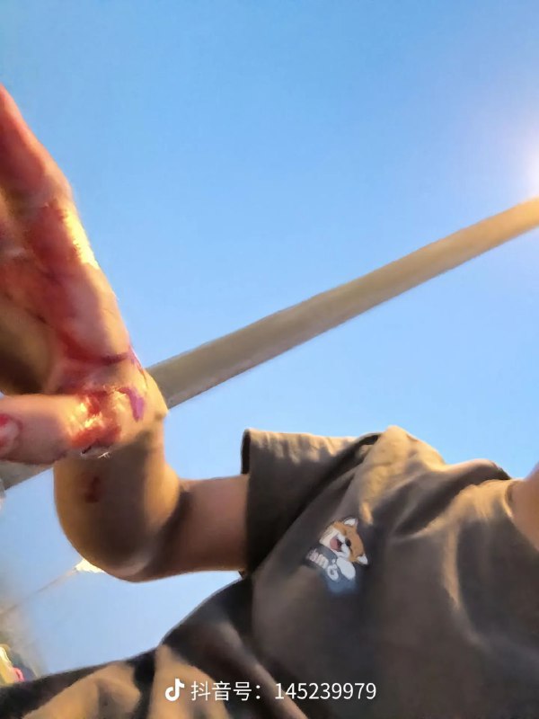 所以起来了吗🤣 让腊肉打赢复活赛 为你主持公道By