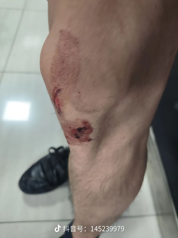 所以起来了吗🤣 让腊肉打赢复活赛 为你主持公道By