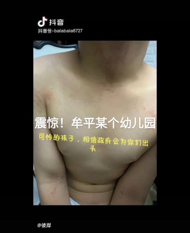 大绝育运动的食堂投稿By