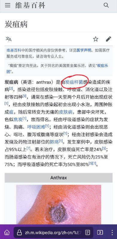 不懂就问，鼠疫、炭疽和霍乱是病毒引起的吗？#科普向By