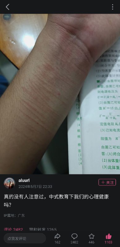 评论区相当哈人，全是自残的图文By