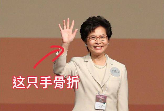 林郑月娥跌倒，右手骨折休假期间李家超代理行政长官职务林郑月娥跌倒，右手骨折休假期间李家超代理行政长官职务