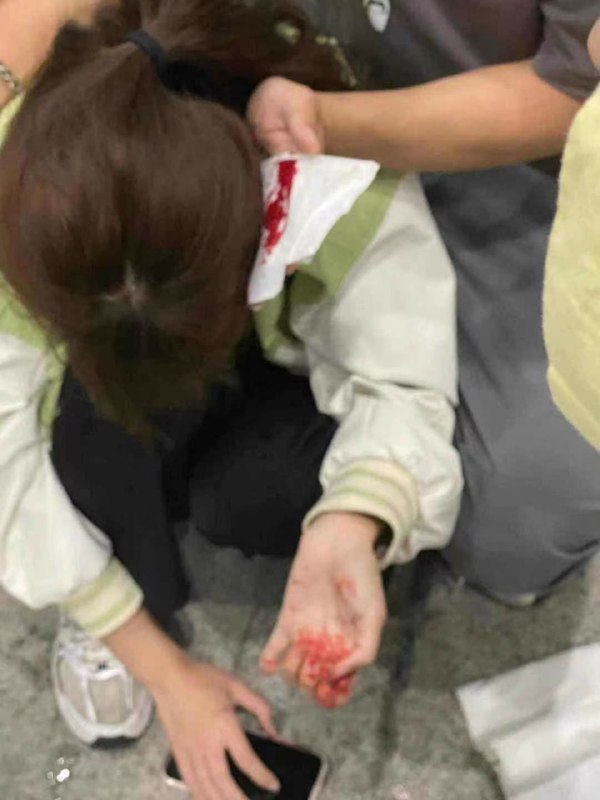 🐸在现场，心疼这妹子……不过不开玩笑，这几天的冲突好在也貌似只有皮外伤，不然如果伤势严重到像香港爆眼女一样，就等着党媒一锤定音给你安排『队友误伤』等离奇故事吧……🐸在现场，心疼这妹子……不过不开玩笑，这几天的冲突好在也貌似只有皮外伤，不然如果伤势严重到像香港爆眼女一样，就等着党媒一锤定音给你安排『队友误伤』等离奇故事吧……