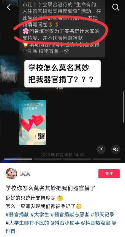 预制器官😁投稿By