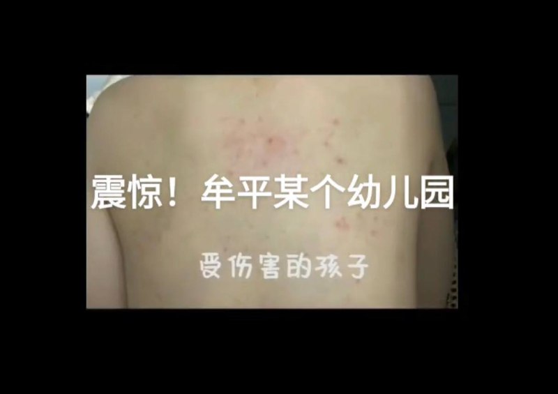 大绝育运动的食堂投稿By