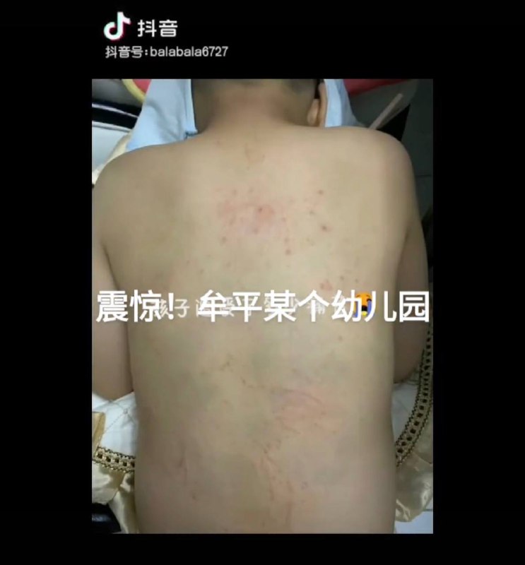 大绝育运动的食堂投稿By