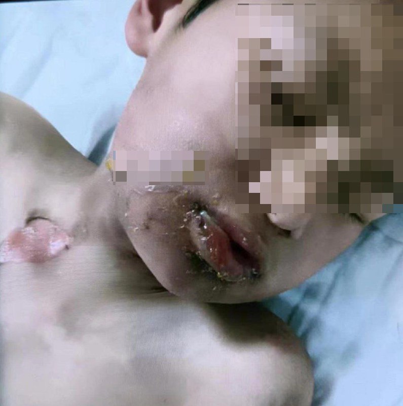本性善良的拆那小孩投稿By