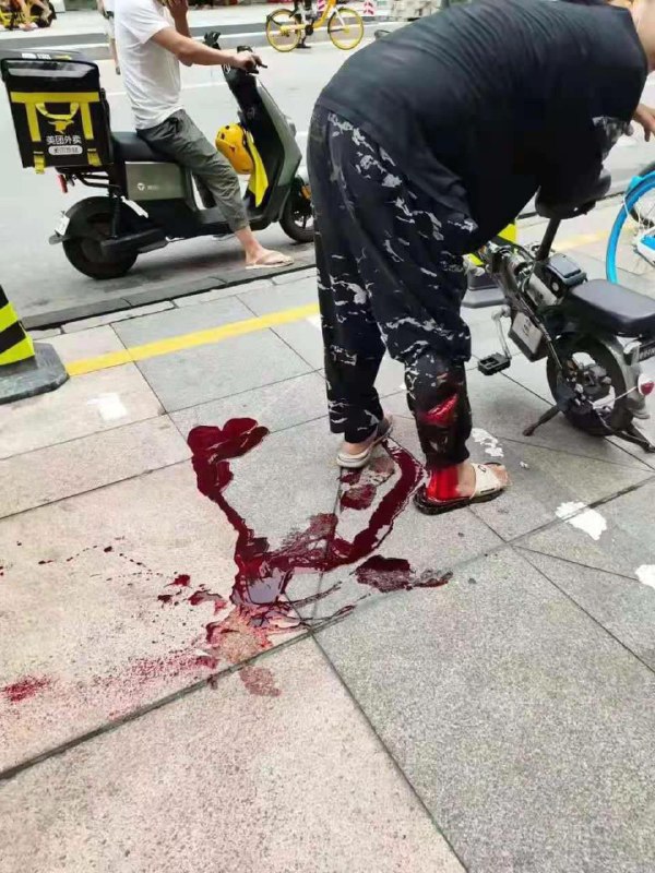 6月10日广东佛山世纪大酒店黑社会开战现场#中国为什么这么安全6月10日广东佛山世纪大酒店黑社会开战现场#中国为什么这么安全